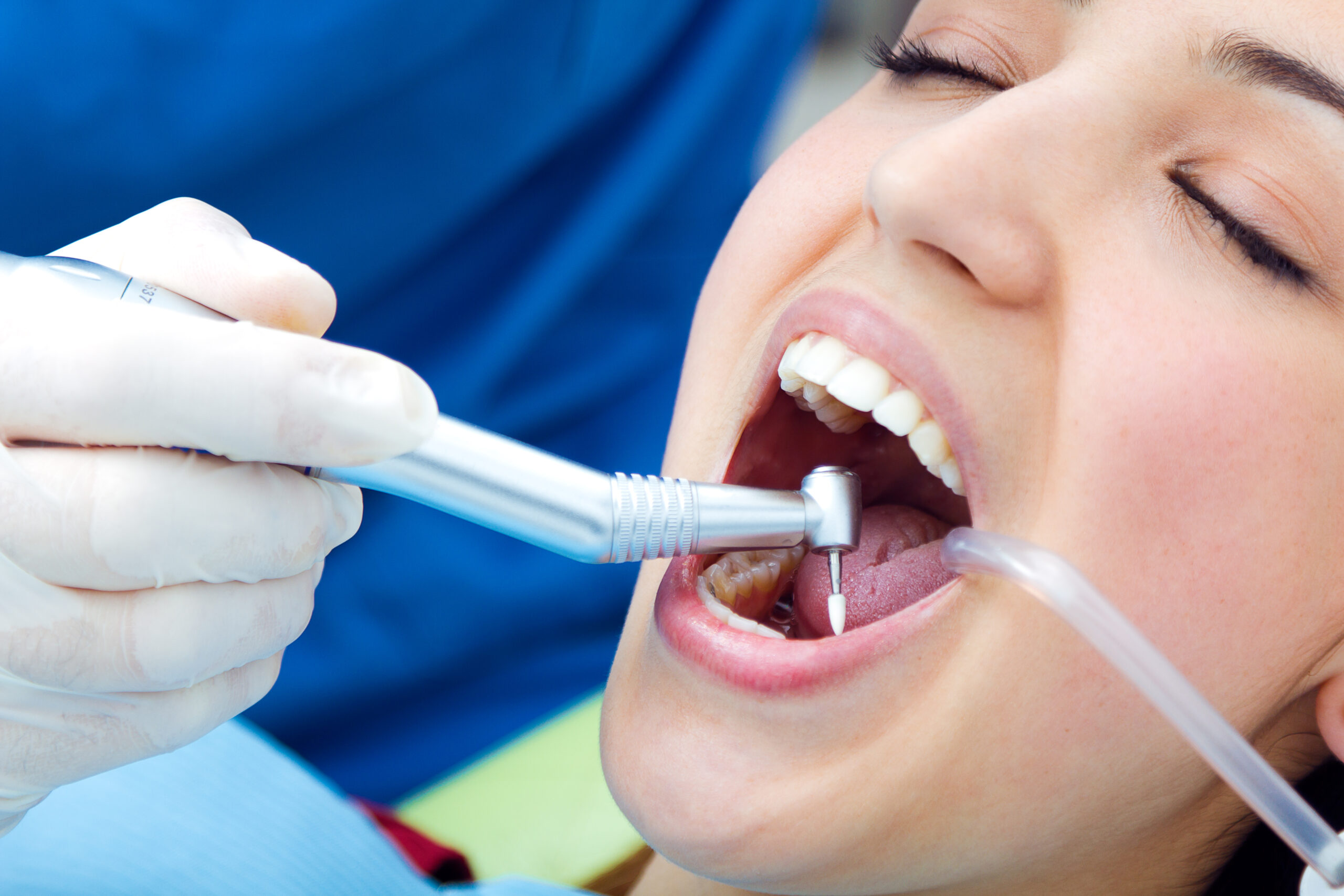 Periodoncia
